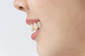 ワキガは手術で治すことができる