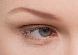 ボトックス注射で肩こりを治すことができます